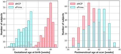 Harmonized Segmentation of Neonatal Brain MRI